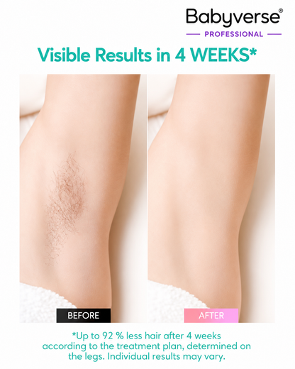 Babyverse IPL Hair Removal Device – Smooth Skin at Home