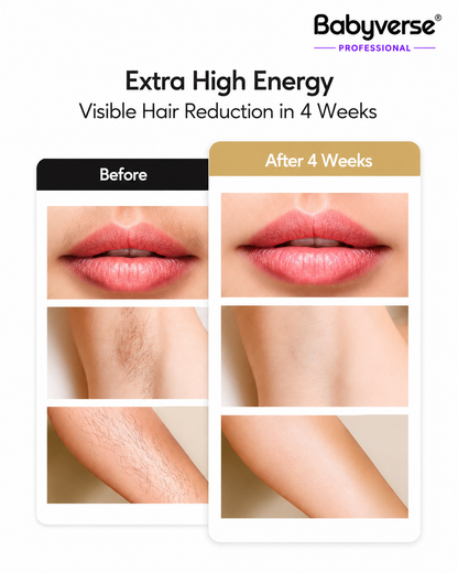 Epura IPL Laser Device – Xenon Quartz Technology