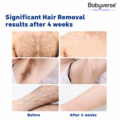 Babyverse IPL Hair Removal Device – Smooth Skin at Home