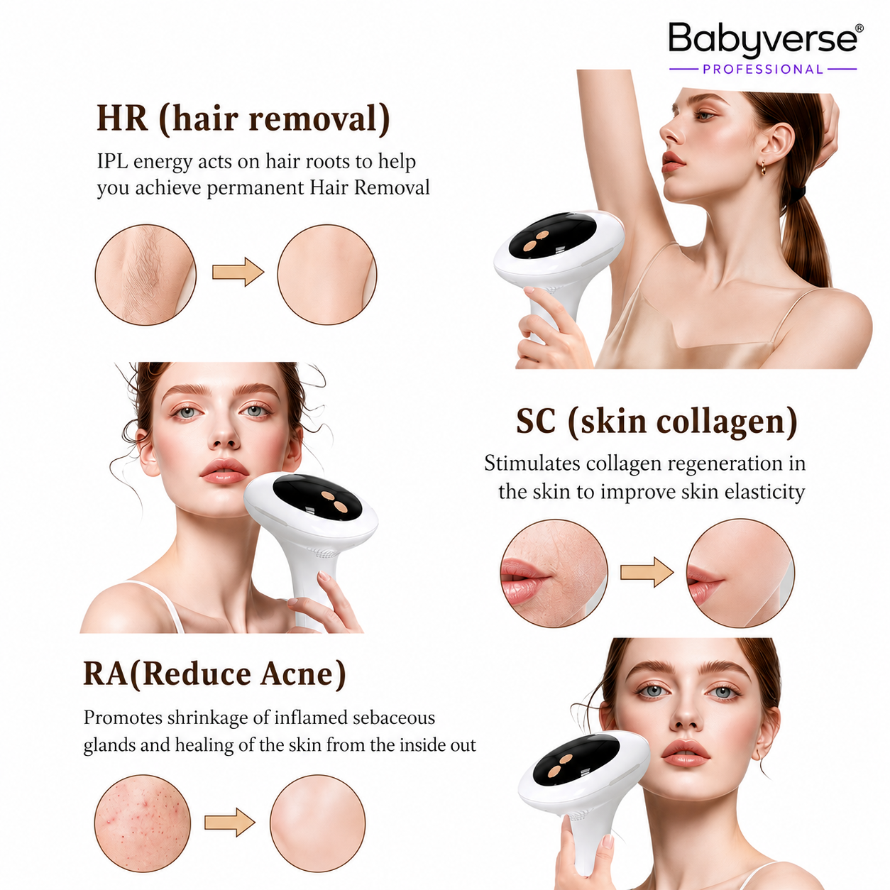 Babyverse IPL Laser Device with Cooling – Pain-Free Hair Removal